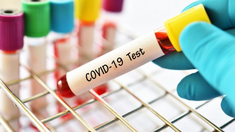 Covid-19 Infection Toll Now at 101,009 Cases, With 153 More Cases Today