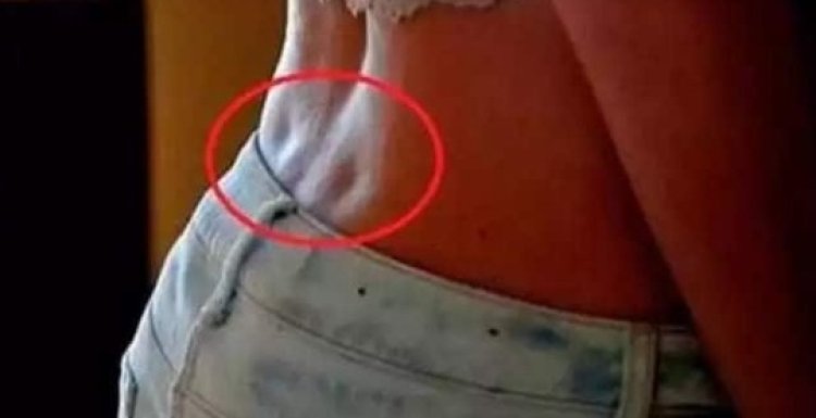 Ever Seen A Person With These Holes On Their Back? Here Is What It Means
